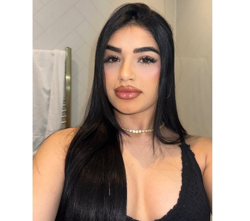 Escorts West Midlands Birmingham - Photos for 🔥 Bruna The Best Brazilian 🇧🇷 Sexy 💯 Real Photos
