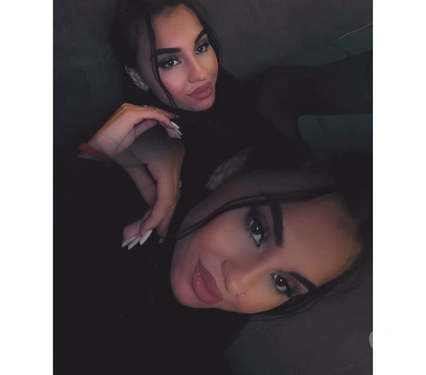 Escorts Norfolk Norwich - Photos for ✨️HI REAL 100% CONFIRM WHATSAPP✨️INCALL&OUTCALL