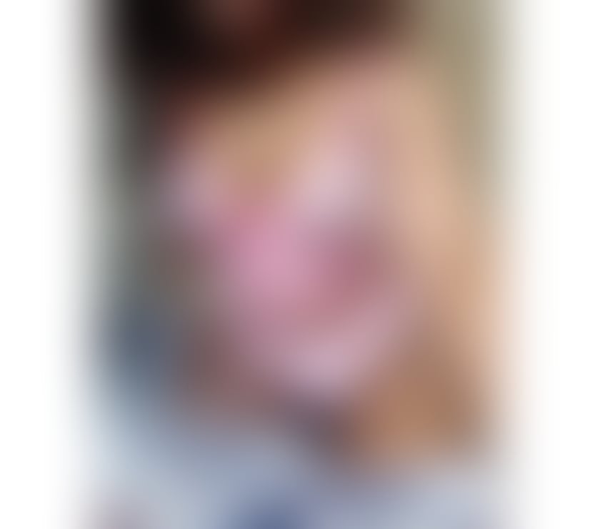 Escorts Dundee Dundee City Centre - Dundee - Photos for stunning leggy Ebony hot 🥵 body , smooth chocolate skin