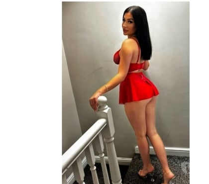 Escorts Dundee City Centre Dundee - Photos for 🔥SENSUAL HOT MASSAGE AND FUN🔥BEST SERVICE🔥