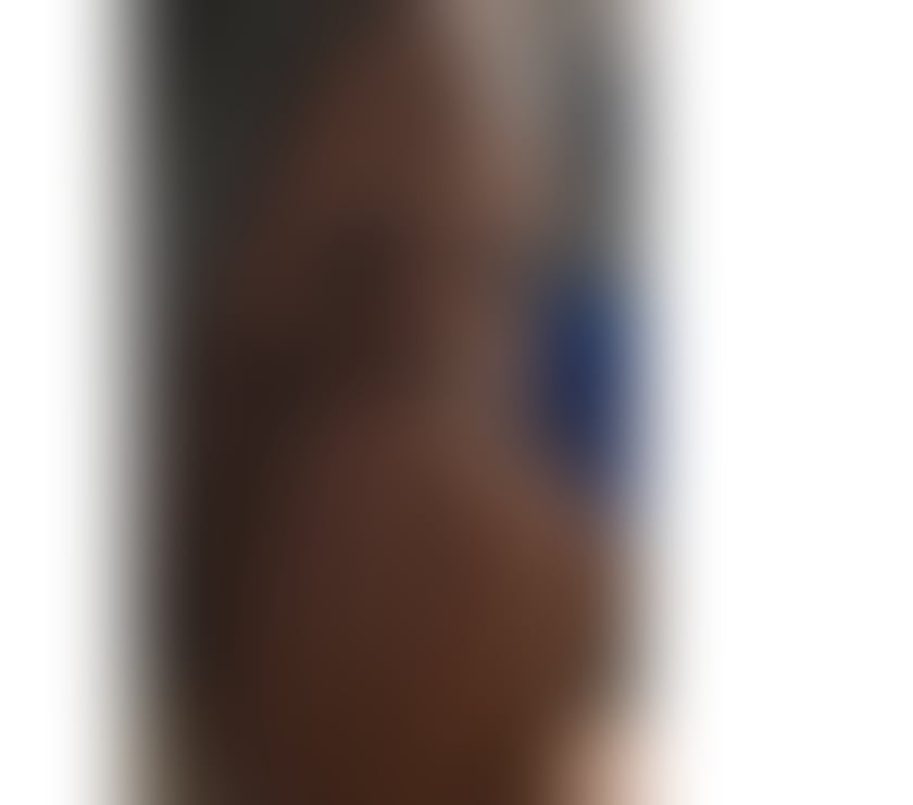 Escorts East London Walthamstow - East London - Photos for 🌹ALARA NEW IN YOUR AREA OUTCALL ONLY ❤️‍🔥