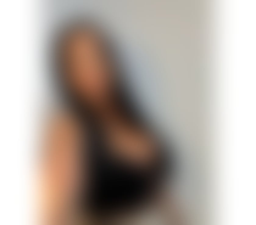Escorts Ormeau Belfast - Photos for Alexya ❤️Just arrived in the area 🎊 party 🍾