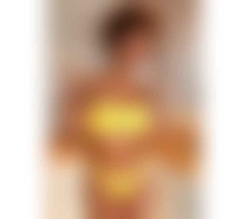 Escorts Muirend Glasgow - Photos for Melanie Brown - Brazilian🔥