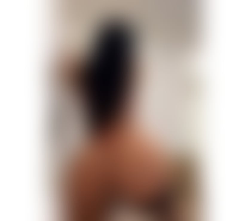 Escorts Kent Gravesham - Photos for ALMA🔴🔴TANNING BODY 🔴🔴INDEPENDENT SEXY GIRL