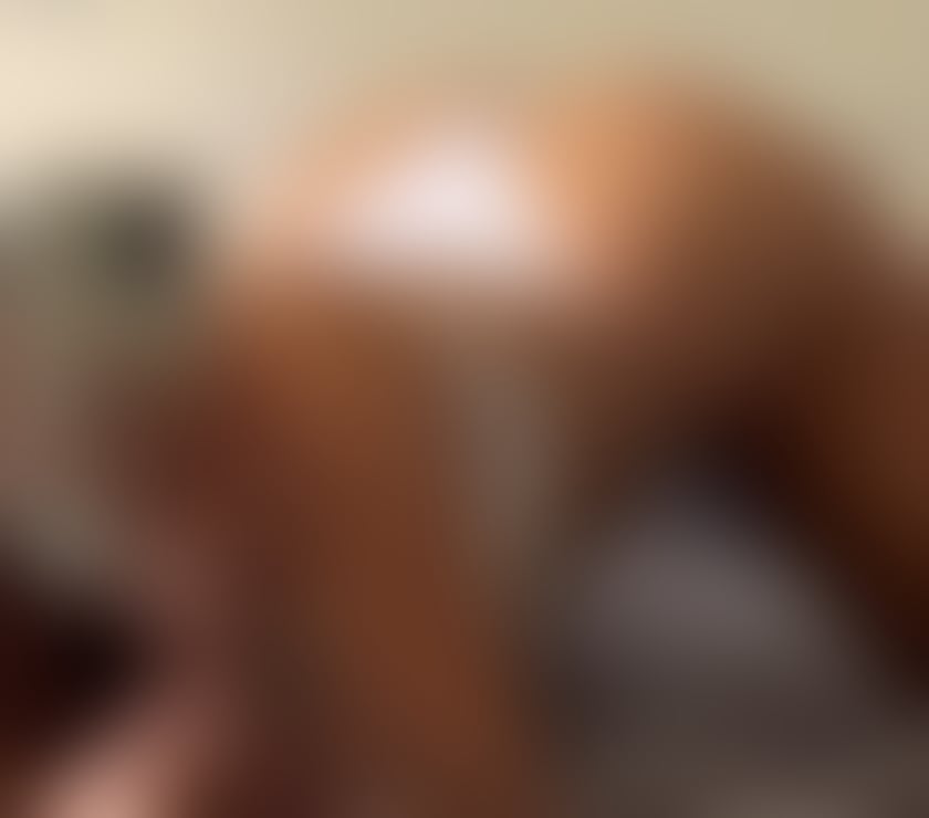 Escorts Kent Gravesham - Photos for ALMA🔴🔴TANNING BODY 🔴🔴INDEPENDENT SEXY GIRL