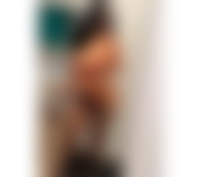 Escorts Kent Gravesham - Photos for ALMA🔴🔴TANNING BODY 🔴🔴INDEPENDENT SEXY GIRL