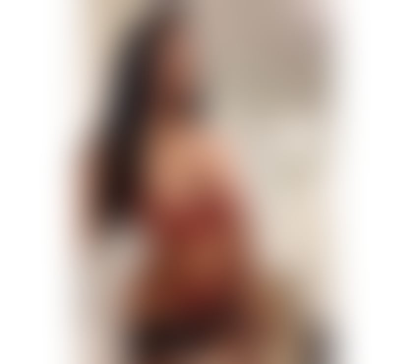 Escorts Kent Gravesham - Photos for ALMA🔴🔴TANNING BODY 🔴🔴INDEPENDENT SEXY GIRL