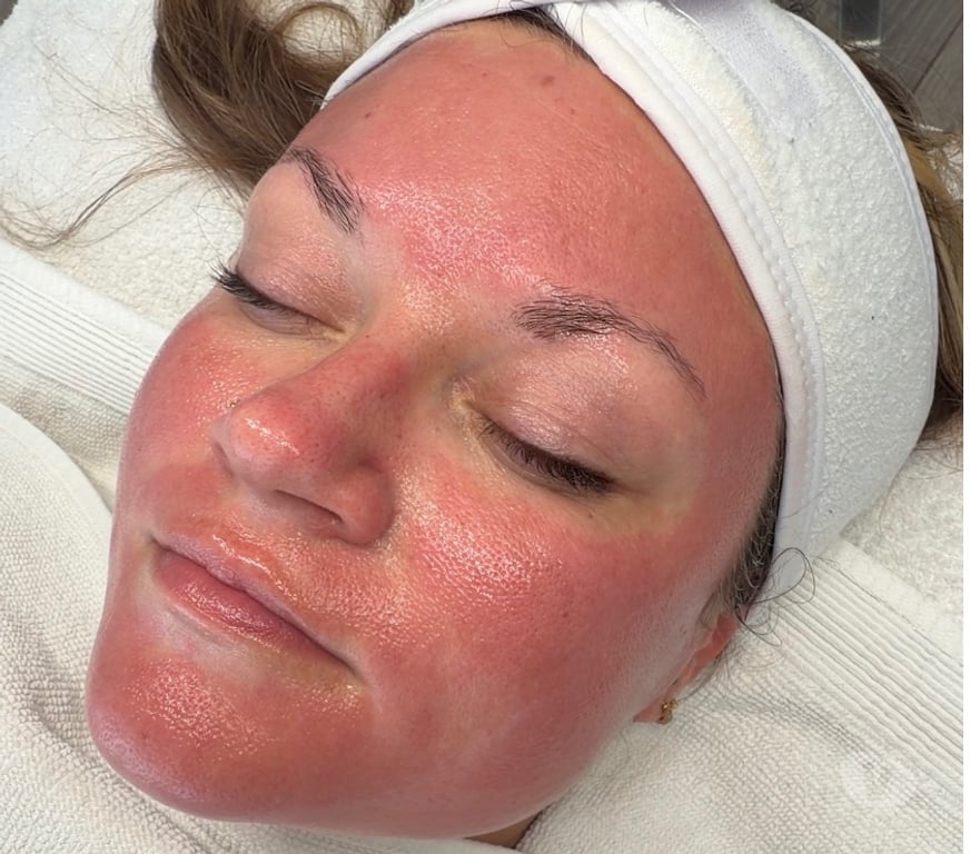 Health-Beauty Staffordshire East Staffordshire - Photos for Facials & Laser Hair Removal Clinic Burton on Trent