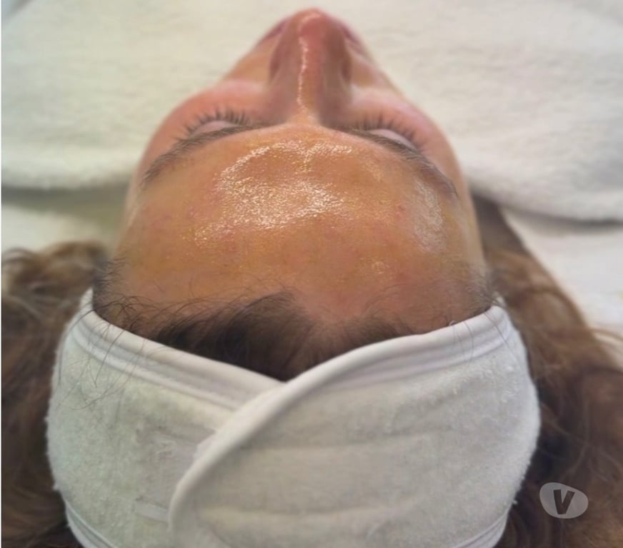 Health-Beauty Staffordshire East Staffordshire - Photos for Facials & Laser Hair Removal Clinic Burton on Trent