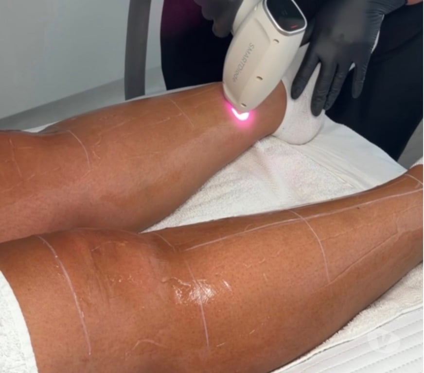 Health-Beauty Staffordshire East Staffordshire - Photos for Facials & Laser Hair Removal Clinic Burton on Trent