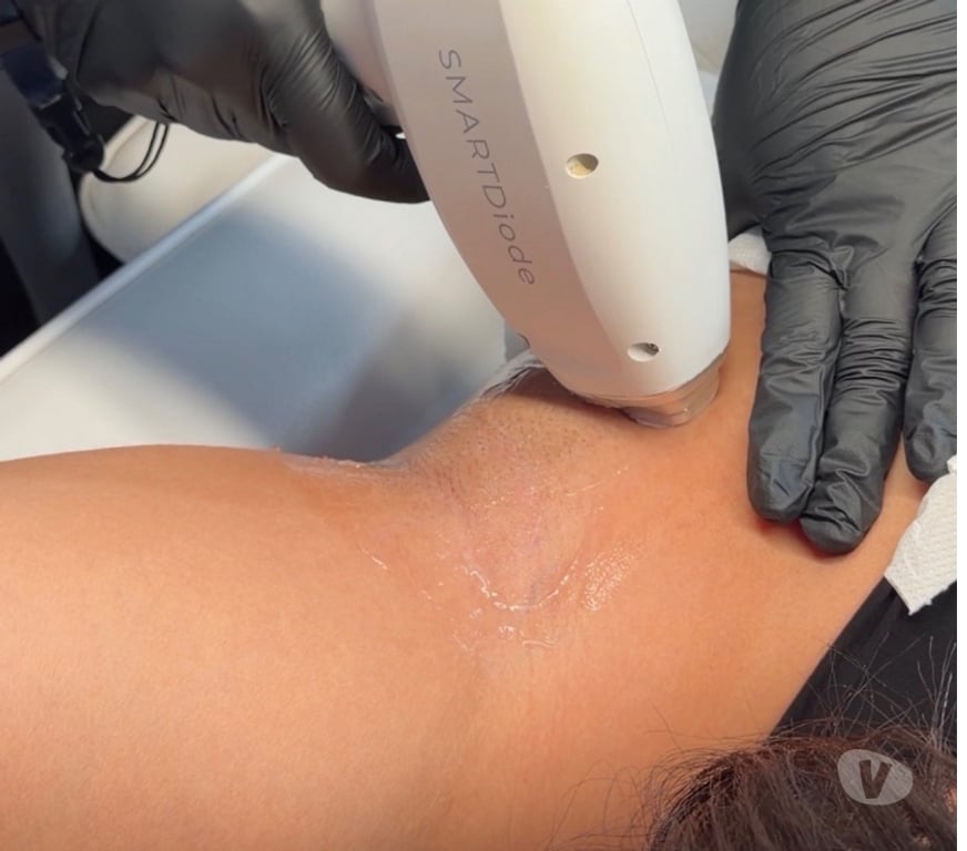 Health-Beauty Staffordshire East Staffordshire - Photos for Facials & Laser Hair Removal Clinic Burton on Trent