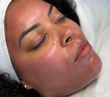 Photos for Facials & Laser Hair Removal Clinic Burton on Trent