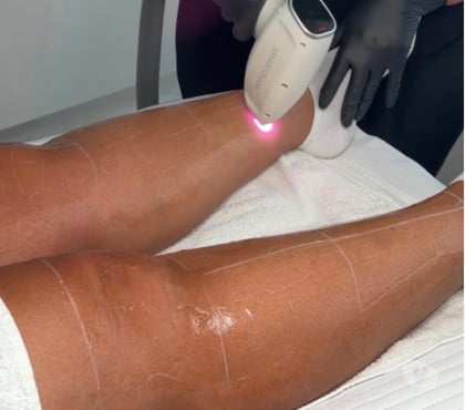 Health-Beauty Burton-on-Trent East Staffordshire - Photos for Facials & Laser Hair Removal Clinic Burton on Trent