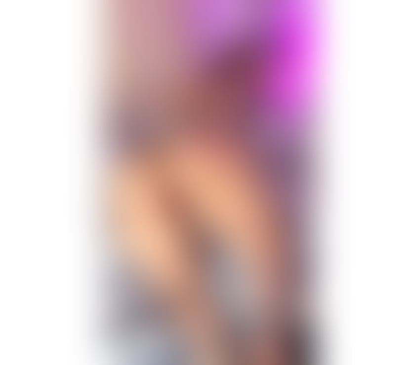 Escorts South East London Deptford - South East London - Photos for RED SEXY🇧🇷BIG ASS🐆MASSAGEM🍑NO RUSH🦊PARTY