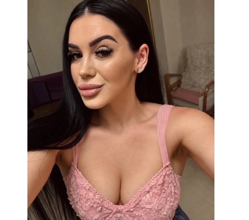 Escorts Kent Medway - Kent - Photos for ✅Anne — Outcall Ready | Party Vibes✅