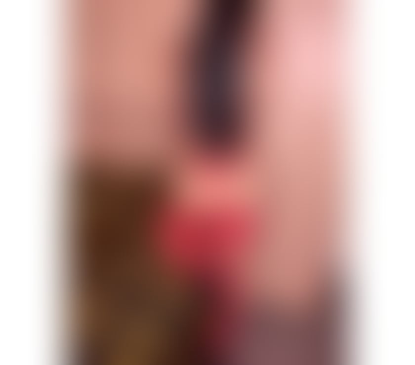 Escorts Fife Dunfermline - Fife - Photos for HOT 🔥 EXOTIC GIRL IN TOWN❤️