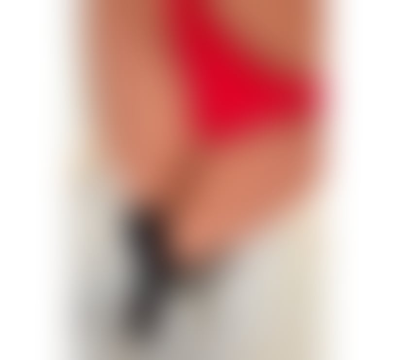 Trans Escorts West London Acton - West London - Photos for Ladyboy Available For you 🫦🍑🫶🏻