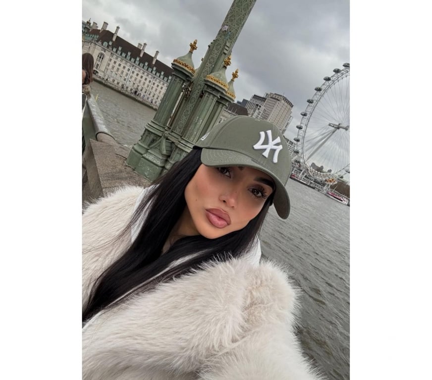 Escorts South Yorkshire Sheffield - Photos for 🍭ANA 🌶️🍭😈 PARTY GIRL⭐️💯real