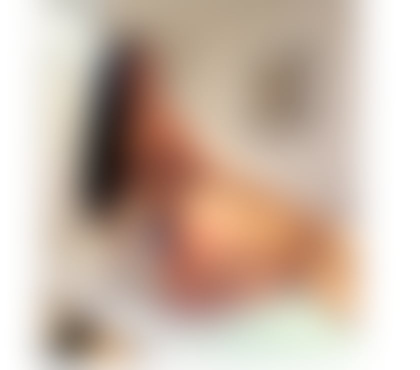Trans Escorts West Midlands Birmingham - Photos for 🍒 Blanc Brazilian Model 🍒