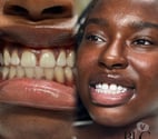TEETH WHITENING + TOOTH GEMS | BIRMINGHAM | APPOINTMENTS
