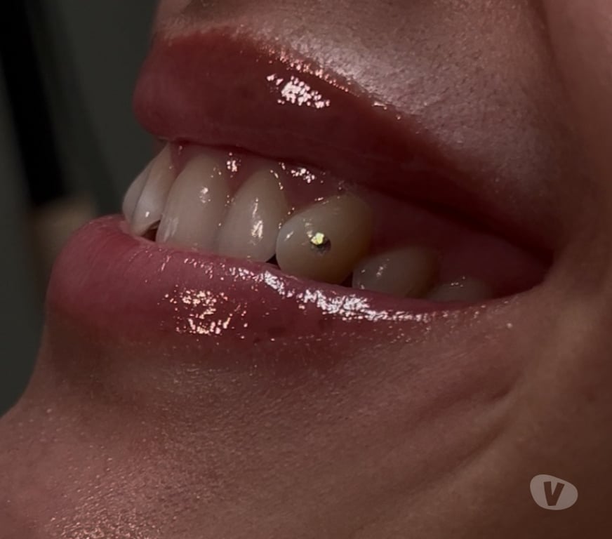 Health-Beauty West Midlands Birmingham - Photos for TEETH WHITENING + TOOTH GEMS | BIRMINGHAM | APPOINTMENTS