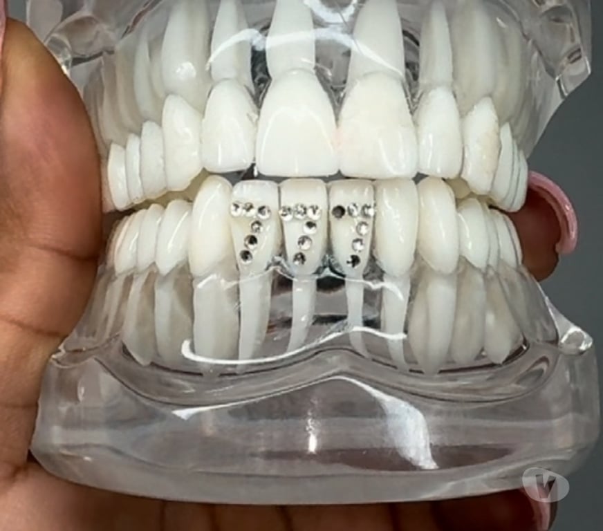Health-Beauty West Midlands Birmingham - Photos for TEETH WHITENING + TOOTH GEMS | BIRMINGHAM | APPOINTMENTS