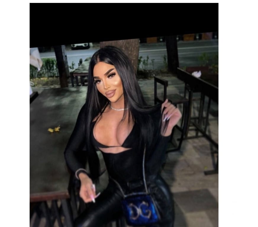 Escorts Staffordshire Stoke-on-Trent - Photos for NEW IN TOWN ANA TS🏳️‍🌈 HIGH CLASS NAUGHTY TS