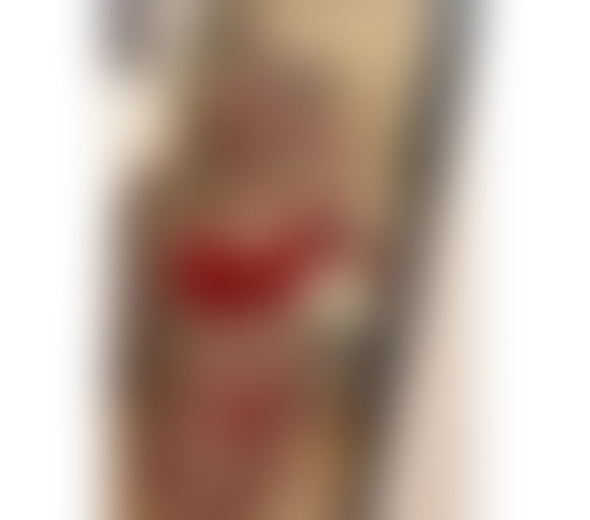 Escorts Edinburgh Edinburgh Bioquarter - Edinburgh - Photos for BIANCA BEST MASSAGE BODY TO BODY WITH OIL👅💦HAPPY