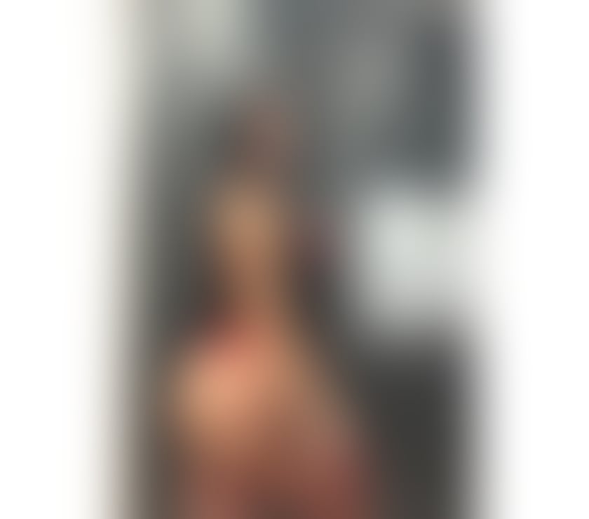 Escorts West Midlands Birmingham - Photos for ✨✅SOFIE BACK IN TWON BIG ASS KISS FREE✨✅
