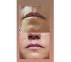 Deptford - South East London — Facial, Body & Aesthetic Treatments London | Luxury Advanced