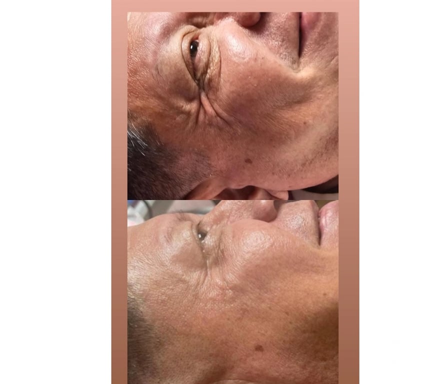 Health-Beauty South East London Deptford - South East London - Photos for Facial, Body & Aesthetic Treatments London | Luxury Advanced