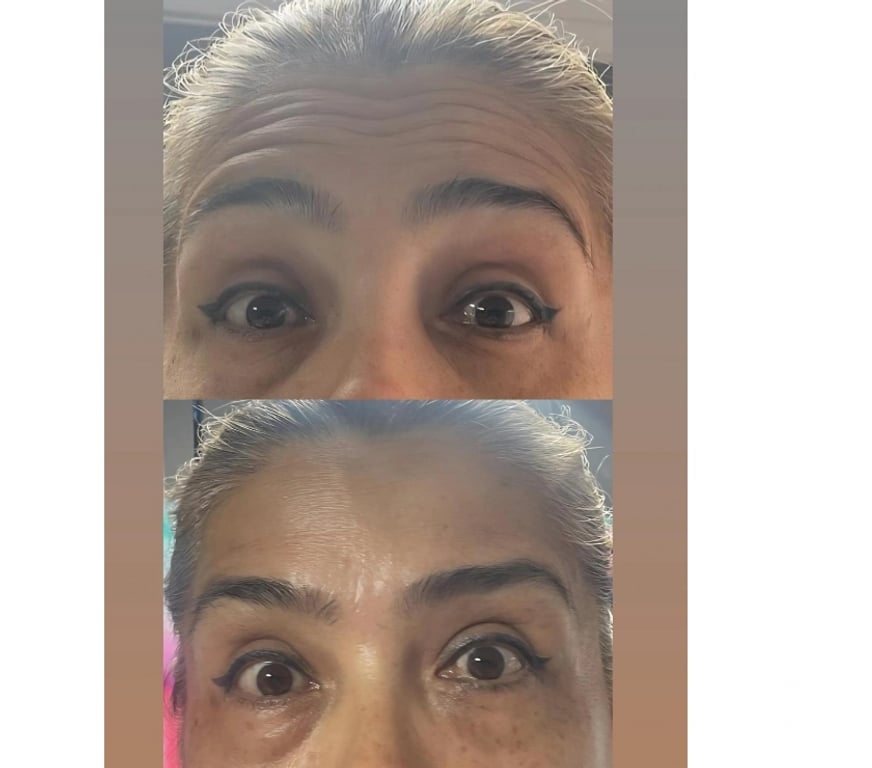Health-Beauty South East London Deptford - South East London - Photos for Facial, Body & Aesthetic Treatments London | Luxury Advanced