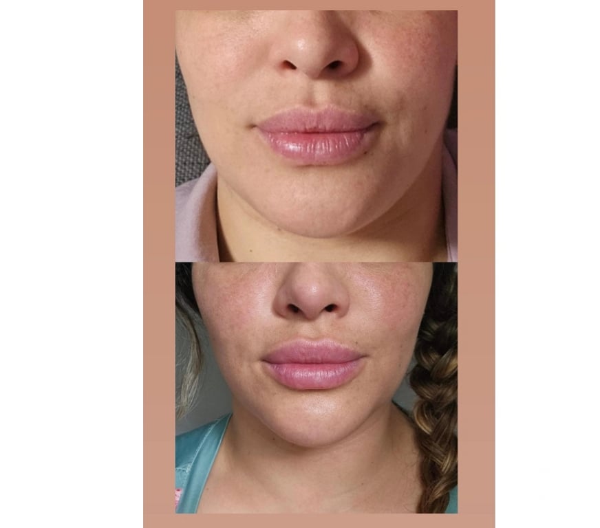 Health-Beauty South East London Deptford - South East London - Photos for Facial, Body & Aesthetic Treatments London | Luxury Advanced
