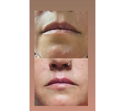 Health-Beauty Deptford South East London - Photos for Facial, Body & Aesthetic Treatments London | Luxury Advanced