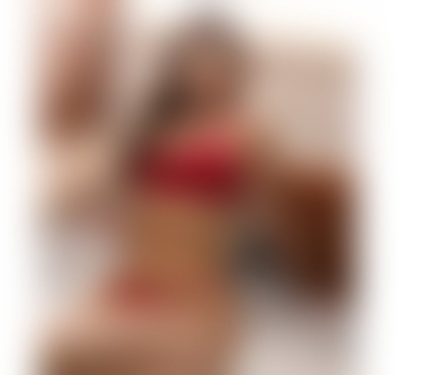 Escorts West Midlands Birmingham - Photos for RAFAELA✨BRAZILIAN SEXY🇧🇷LUXURY SCORT❤️‍🔥