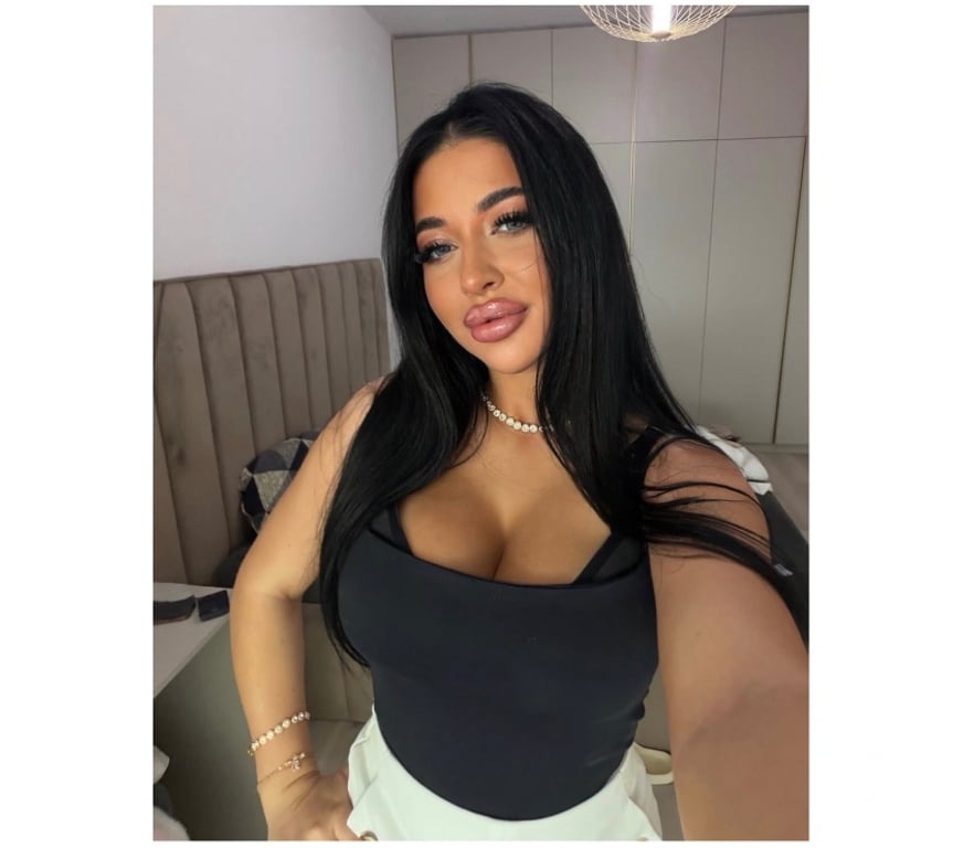 Escorts Cambridgeshire Cambridge - Photos for Catharine🩷NewHere🩷NoRush🩷