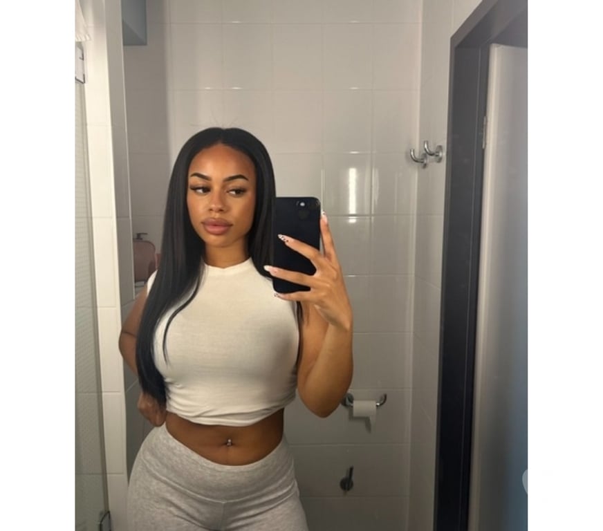 Escorts Fife Kirkcaldy - Fife - Photos for 💕 CAROLINA — A LITTLE SUNSHINE IN YOUR DAY