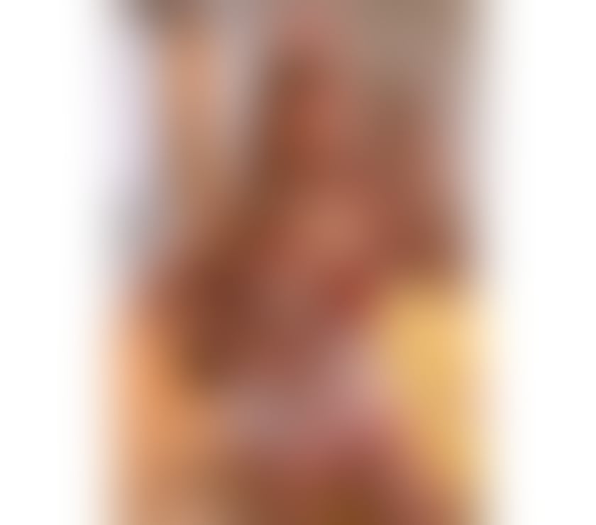 Escorts South East London Catford - South East London - Photos for 🔥PARTY GIRL NEW IN TOWN 🍑🔥💯LARA 💯