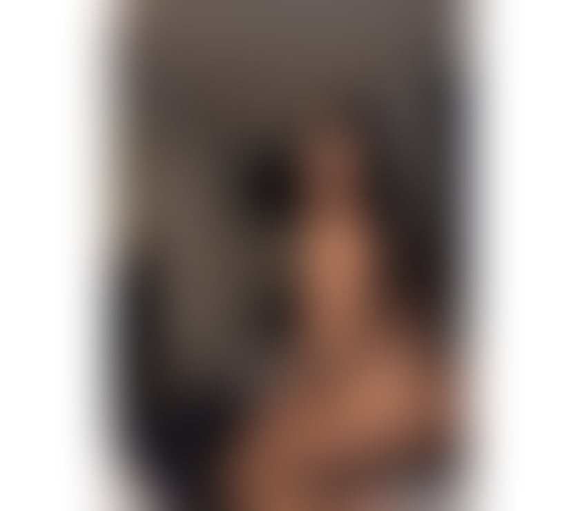 Escorts Hull Hull City Centre - Hull - Photos for TRANSEXUAL 💋 TOP & BOTTOM | VERSATILE | SEXY & GORGEOUS