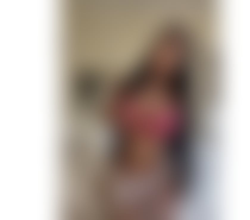 Escorts Dundee Dundee City Centre - Dundee - Photos for 🔥SENSUAL HOT MASSAGE AND FUN🔥PARTY GIRL