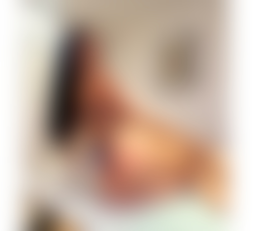 Trans Escorts Buckinghamshire Milton Keynes - Photos for 🍒BLANC BRAZILIAN MODEL🍒
