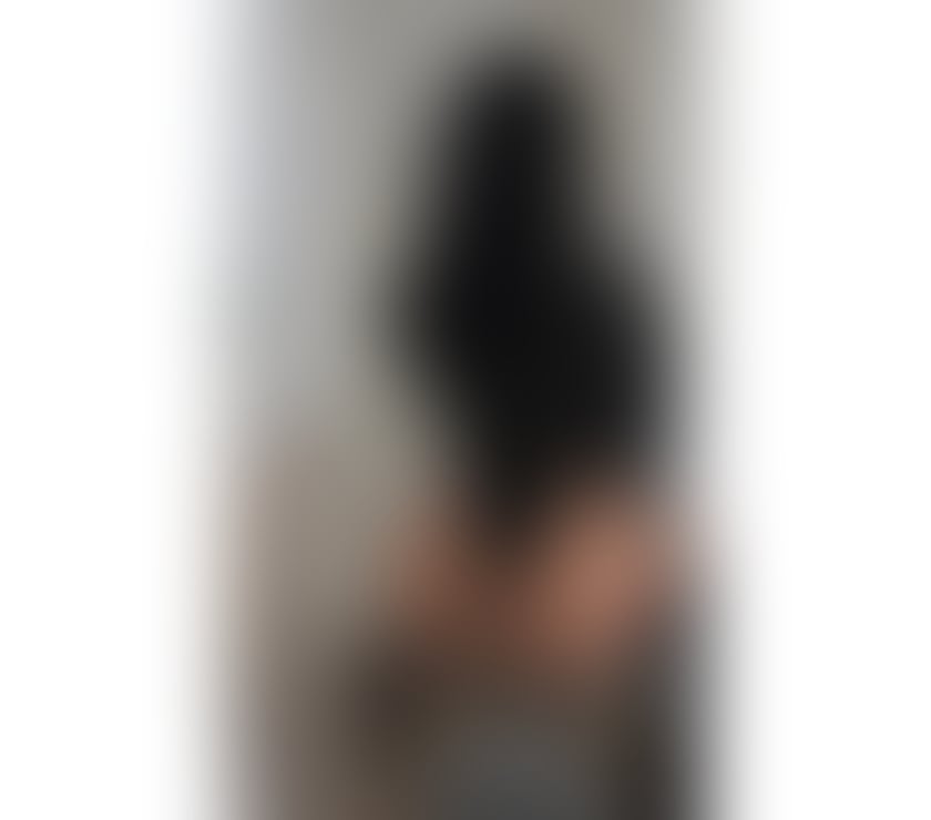 Escorts Surrey Waverley - Photos for NEW PARTY GIRL IN TOWN🔥‼️NO RUSH‼️