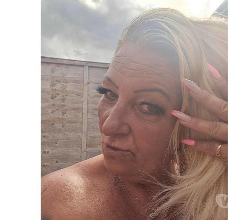 Escorts Hampshire Portsmouth - Photos for CHLOE ❤️ NEW HUNGARY ❤️ LADY 💯💗