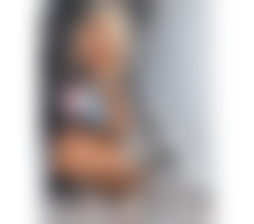 Escorts Surrey Reigate and Banstead - Photos for ❎❇️BIANCA NEW EXCORTE JUST OUTCOLL ❤️❇️