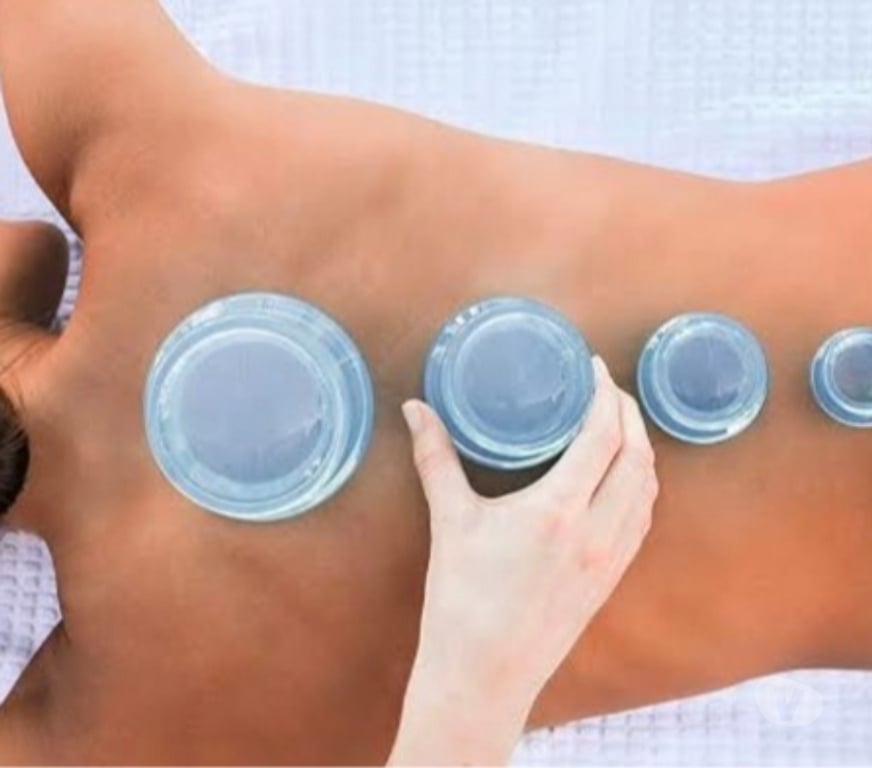 Massage - Beauty - Spa Dublin Dublin-8 - Photos for Cupping massage, cupping massage, cupping massage