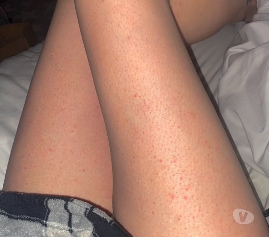 Gay Dating Galway Barna-Galway - Photos for Honey Ege for fun.