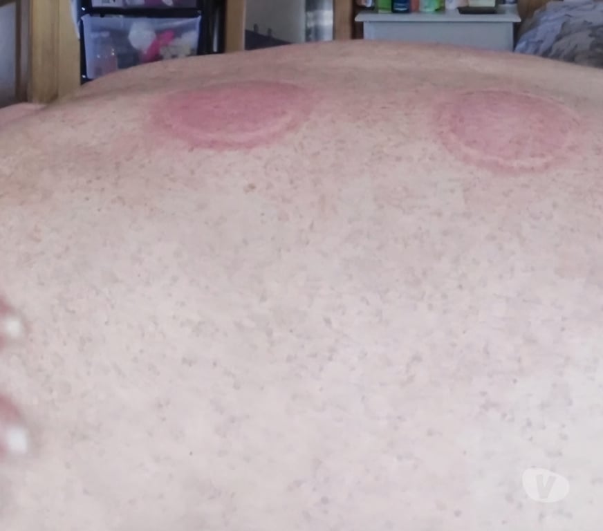 Massage - Beauty - Spa Kilkenny Graiguenamanagh - Photos for New Cupping Massage Therapy With British Elly