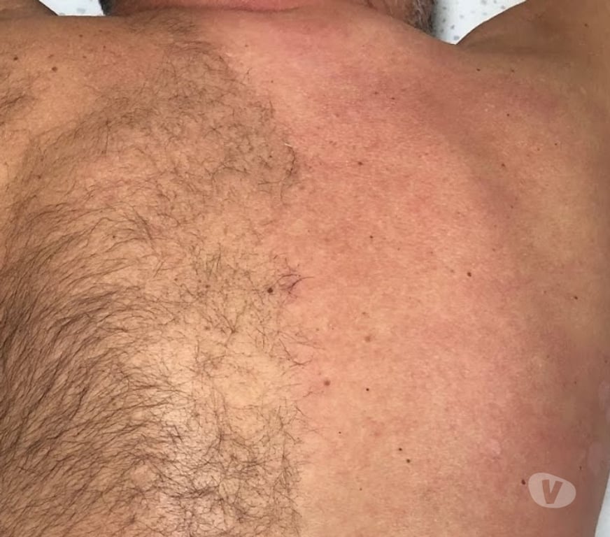 Massage - Beauty - Spa Limerick Limerick - Photos for Male massage by male therapist