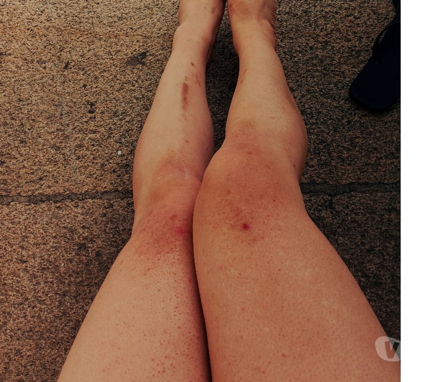 Massagem Maia - Fotos para ScarletCanary Domada pelo VĂcio